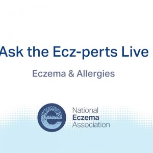 Eczema and Allergies