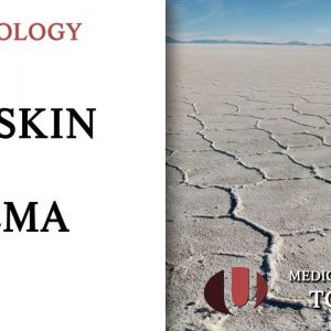 Dry Skin Eczema