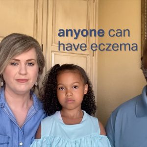 1 in 10 people have eczema