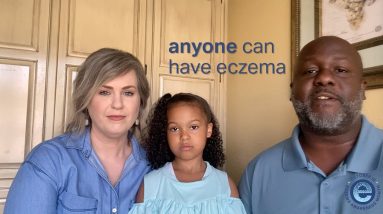 1 in 10 people have eczema