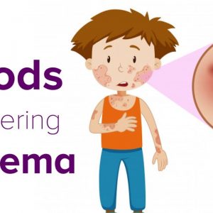 Foods triggering eczema flare up