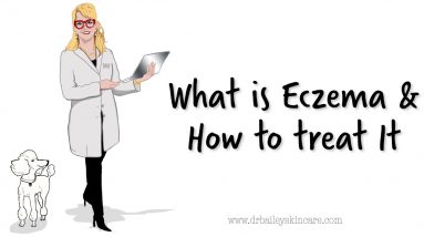 What if I have eczema