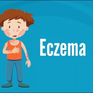 Eczema epidemic