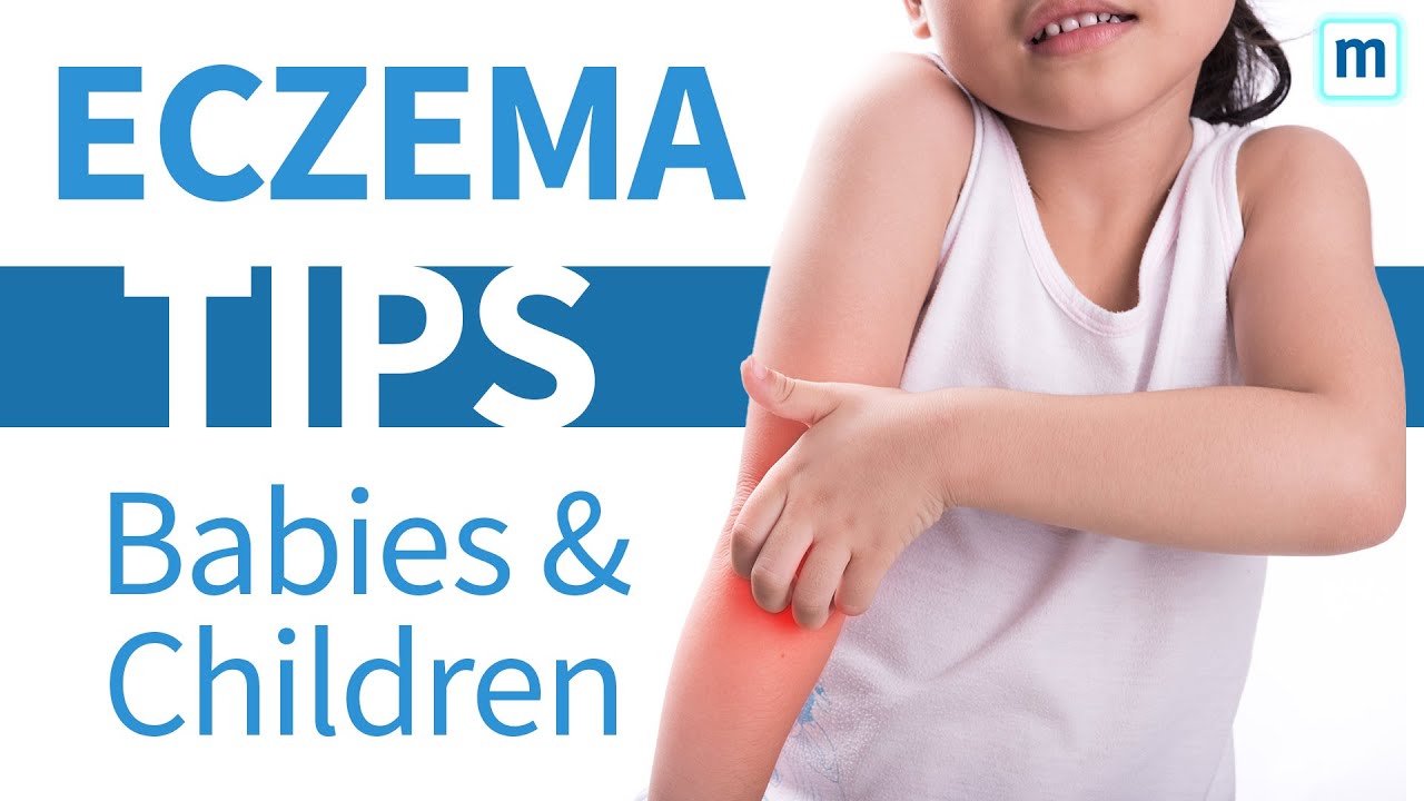 Eczema In Babies And Children Avoid Soaps