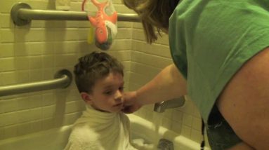 kids with severe eczema
