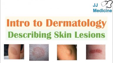 Eczema and related skin conditions