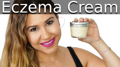 DIY Eczema Cream - Itchy Skin Relief 6 1680275274 maxresdefault
