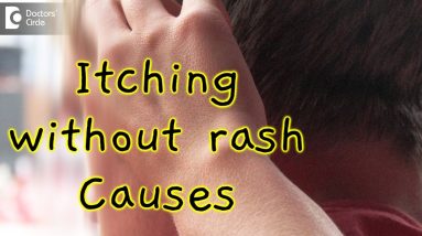 What causes itching all over without a rash? - Dr. Rasya Dixit 2 1680277336 maxresdefault