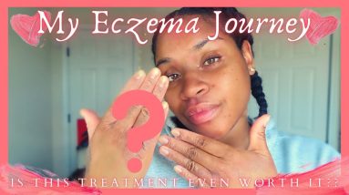 How I’m Getting My Chronic Eczema Under Control: Dupixent Journey | 2nd Injection + 1 Month Update 18 1680278522 maxresdefault