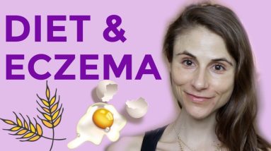 DIET & SUPPLEMENTS FOR ECZEMA: Q&A WITH DERMATOLOGIST DR DRAY 10 1680280548 maxresdefault