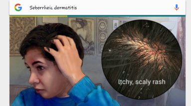 What is eczema 12 1680285913 maxresdefault