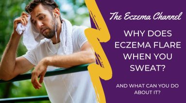 Why Eczema Flares When You Sweat 4 1680288116 maxresdefault