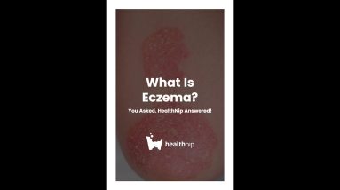 What Is Eczema? 4 1680293511 maxresdefault