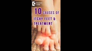 10 Causes of ITCHY FEET & how to get relief? - Dr. Urmila Nischal |Doctors' Circle #shorts 20 1680295678 maxresdefault