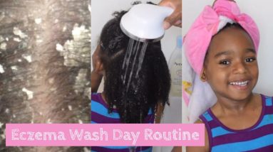 Eczema Wash Day Routine For Kids No More Itchy Scalp| Seborrheic DERMATITIS 16 1680297091 maxresdefault