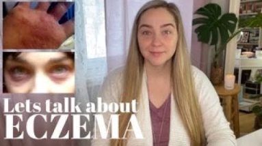 What is eczema? 10 1680297763 hqdefault