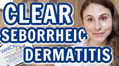 How to CLEAR SEBORRHEIC DERMATITIS on the face| Dr Dray 6 1680299462 maxresdefault