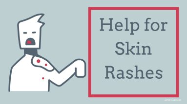 How to Improve Skin Rashes Like Eczema and Psoriasis 12 1680309574 maxresdefault