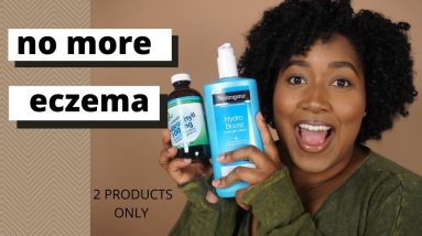 How I Cleared the Eczema on my hands and feet with these 2 products ➤ Dominique Denesha 2 1680312429 maxresdefault