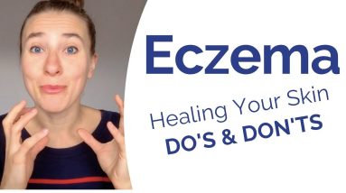 Eczema - What Really Causes It & Most Powerful Do’s & Don’t to Start Healing Your Skin Now 16 1680313910 maxresdefault