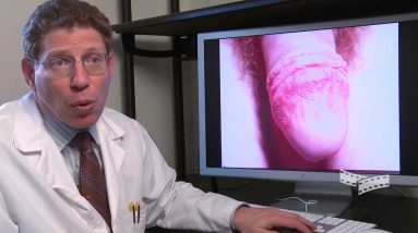Extreme Diagnosis: Uncommon Symptoms 10 1680315114 maxresdefault
