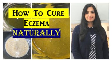 Best Home Remedy For Eczema ⭐| #HomeRemediesforEczema | Samyuktha Diaries 6 1680316893 maxresdefault