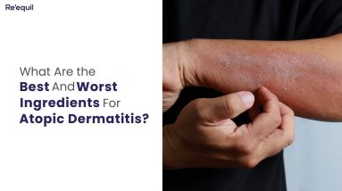 What Are the Best and Worst Ingredients For Atopic Dermatitis? 6 1680321799 maxresdefault
