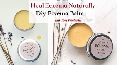 ECZEMA BALM RECIPE with Neem | How we cured Eczema Naturally with Diet Tips | 20 1680323665 maxresdefault