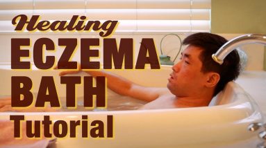 Eczema Bath & Skin Moisturizing Tutorial: Salt, Bleach, Robathol Oil | Ep.219 16 1680324819 maxresdefault