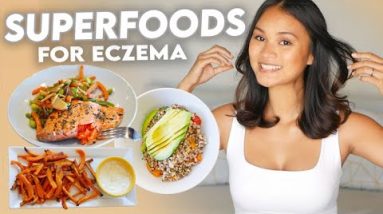 Eczema Diet: What to Eat for Clear Skin! 14 1680325217 hqdefault