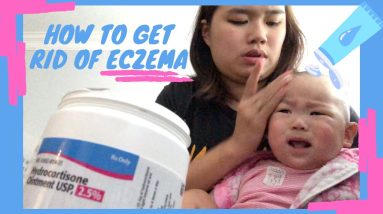HOW TO GET RID OF BABY ECZEMA + 4 month check up! 6 1680327477 maxresdefault