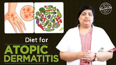 जानिए क्या खाएं Atopic Dermatitis (eczema) में | स्किन स्पेशलिस्ट के द्वारा 10 1680331911 maxresdefault