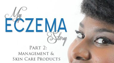 My Eczema Story Part 2: Management & Skin Care Products | MzNaturalLife 8 1680332323 maxresdefault