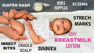 Breast Milk Lotion (Eczema, Diaper Rash, Stretch Marks, Sore Nipples) - NATURAL DIY | ARIBA PERVAIZ 18 1680334861 maxresdefault