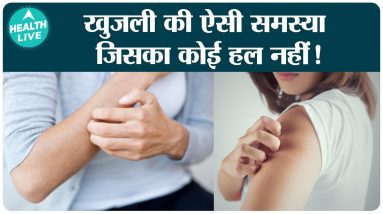 What is Eczema? Does your skin itch really bad? | Health Live 10 1680336883 maxresdefault