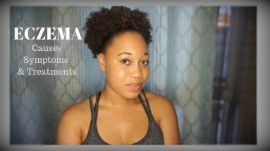Eczema Causes, Symptoms & Treatment | Euniycemari 18 1680340606 maxresdefault