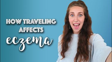 What Causes Eczema Breakouts? | Michelle Mills 10 1680348239 maxresdefault