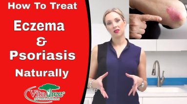 How To Treat Eczema Fast : Treat Psoriasis Naturally - VitaLife Show Episode 180 10 1680358548 maxresdefault