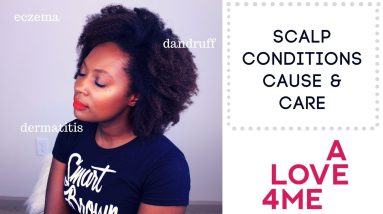 Scalp Conditions - Cause & Care: Eczema, Dandruff, Dermatitis | ***Tip Tuesday*** 8 1680360500 maxresdefault