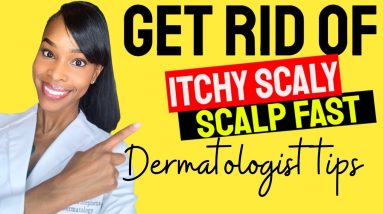 How to get rid of scaly itchy scalp fast #shorts 2 1680361066 maxresdefault