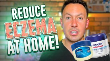 Treatments for eczema at home (Cheap and Easy) 16 1680368357 maxresdefault