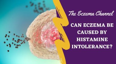 Can Eczema Be Caused by Histamine Intolerance? 16 1680376501 maxresdefault