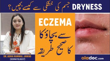 Eczema Ka Ilaj - Skin Dryness Causes - Eczema Treatment Urdu - Skin Ki Khushki Khatam Karne Ke Liye 18 1680381104 maxresdefault
