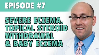 The Eczema Podcast S1E7: Baby Eczema, Severe Eczema & Topical Steroid Withdrawal 12 1680388476 maxresdefault