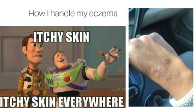 How I control my eczema! 18 1680392311 maxresdefault