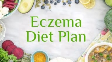 What Food to Eat For Eczema | Eczema Diet Plan | Dermatitis 14 1680393117 hqdefault