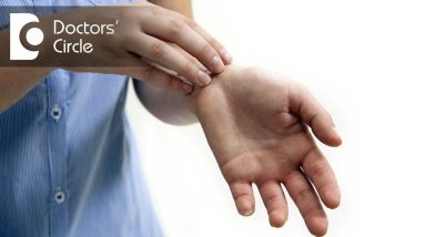 How to treat rashes on hands? - Dr. Rasya Dixit 16 1680399687 maxresdefault