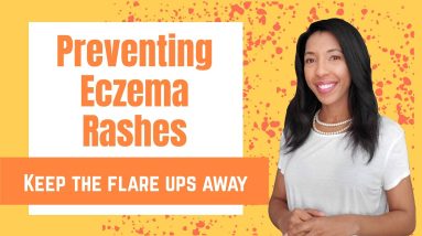 Techniques to TREAT baby ECZEMA | Maintenance (Part 1) 12 1680400001 maxresdefault