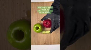 Juice to help Reduce eczema flare ups 16 1680404367 maxresdefault