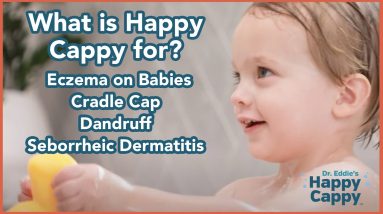 What is Happy Cappy for? Eczema on Babies | Cradle Cap | Dandruff | Seborrheic Dermatitis 18 1680408923 maxresdefault